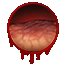 Infected wound
